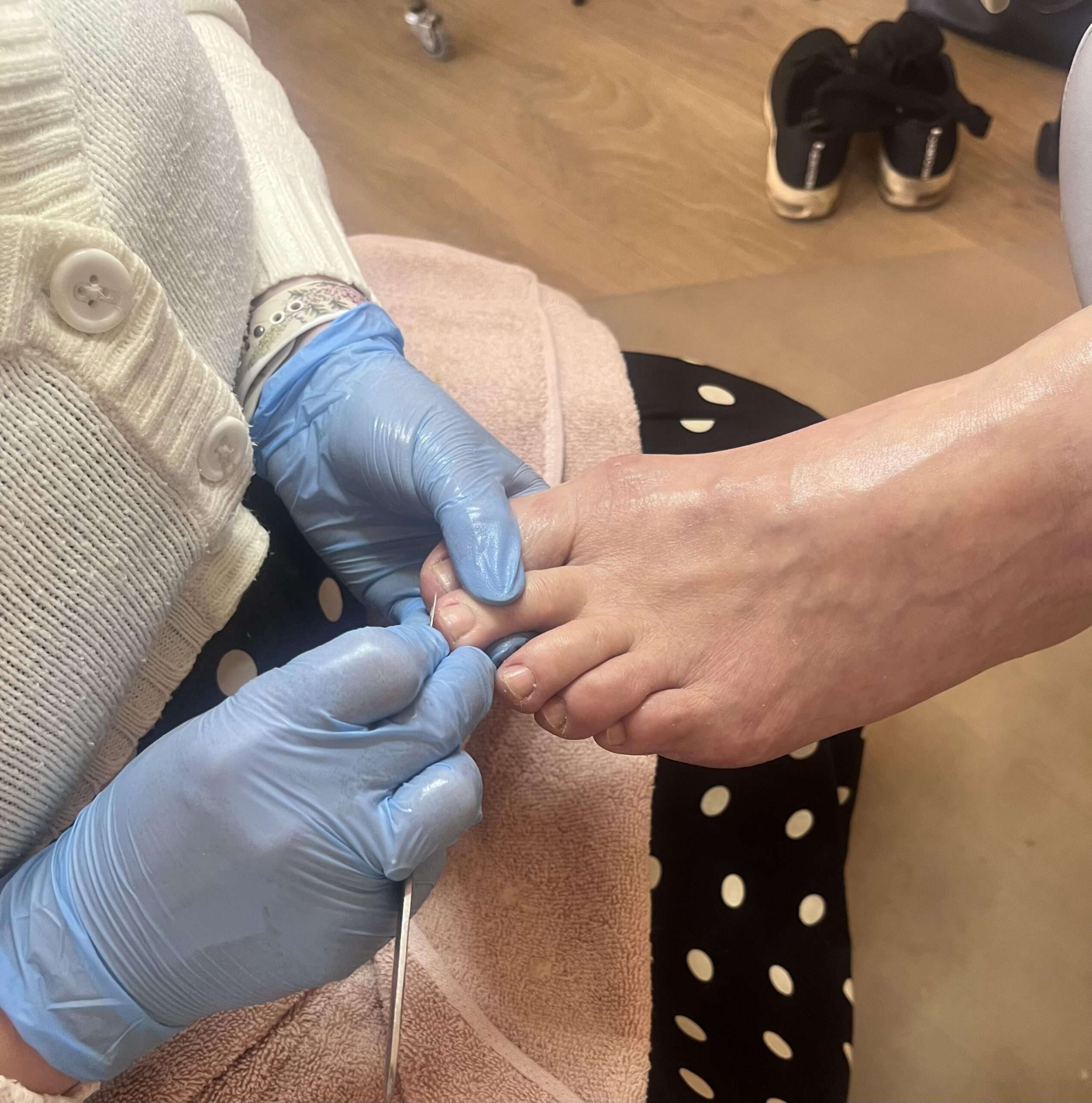 Behandling af negle på fødder i Frederiksværk v ed fodbehnadling af fodplejer i fodplejeklinik